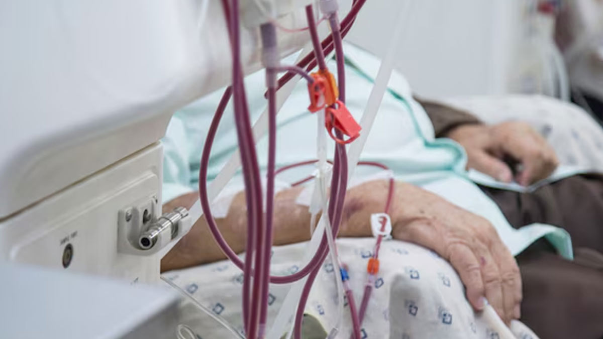 ICU Catheter may cause deadly blood Infection
