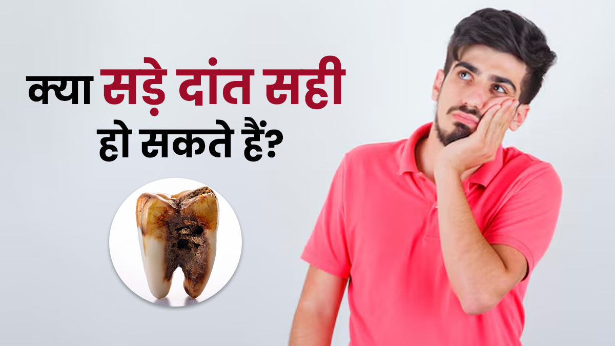 क्या सड़े दांत सही हो सकते हैं? जानें दंत चिकित्सक से सच्चाई