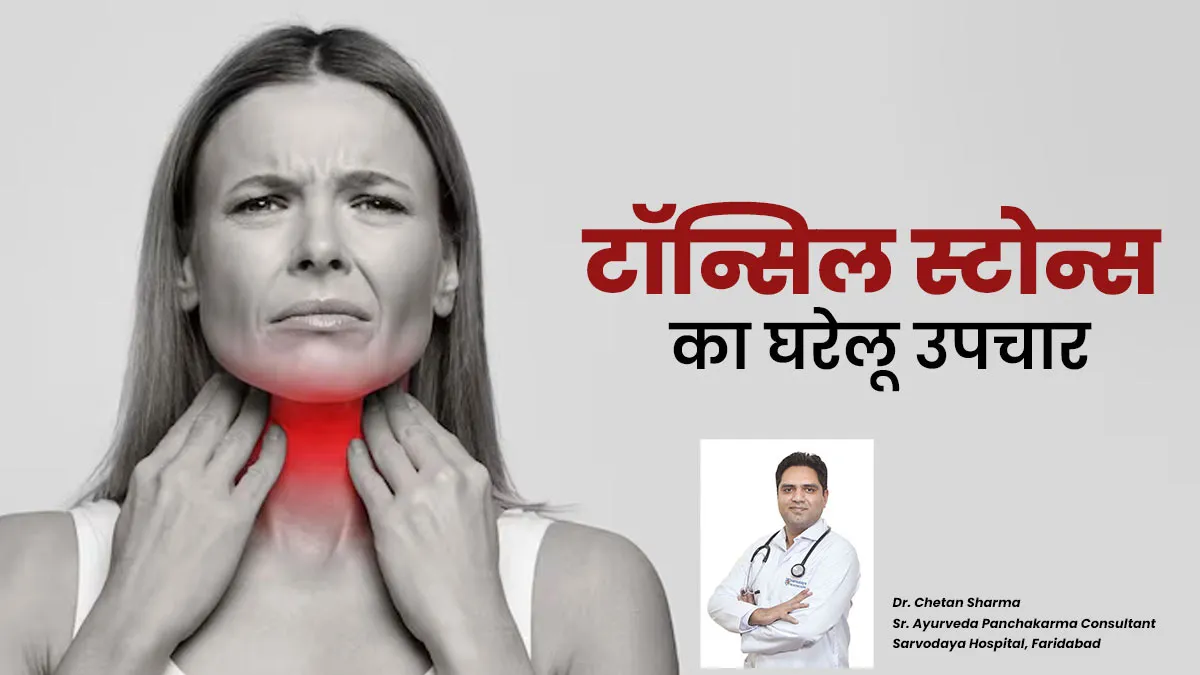 टॉन्सिल स्टोन्स का कैसे करें घरेलू उपचार? जानें आयुर्वेदिक डॉक्टर से