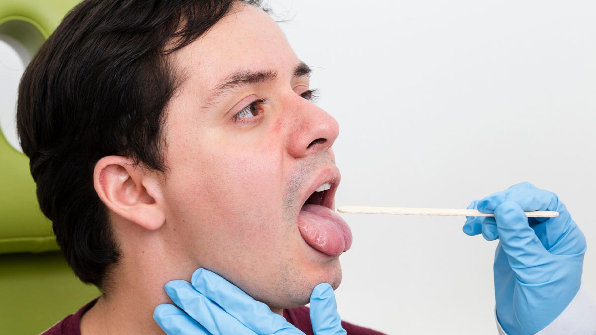 tonsil stones expert advice