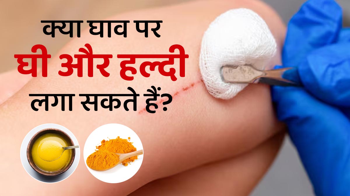 क्या घाव पर घी और हल्दी लगा सकते हैं? जानें आयुर्वेदाचार्य से