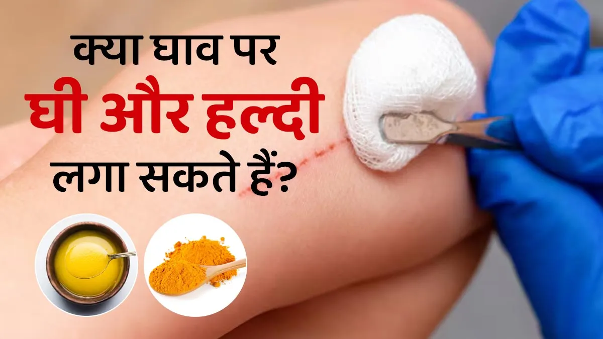 क्या घाव पर घी और हल्दी लगा सकते हैं? जानें आयुर्वेदाचार्य से