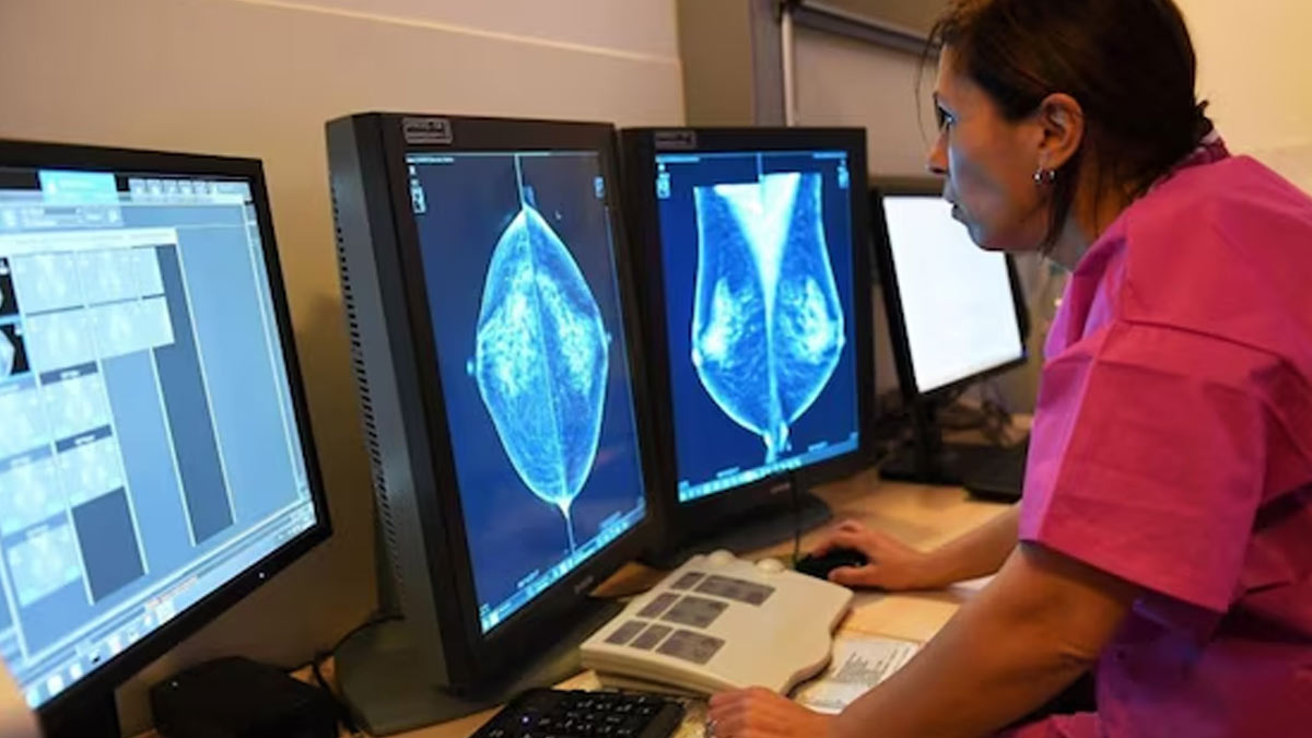 tests for early dedection of cancer expert