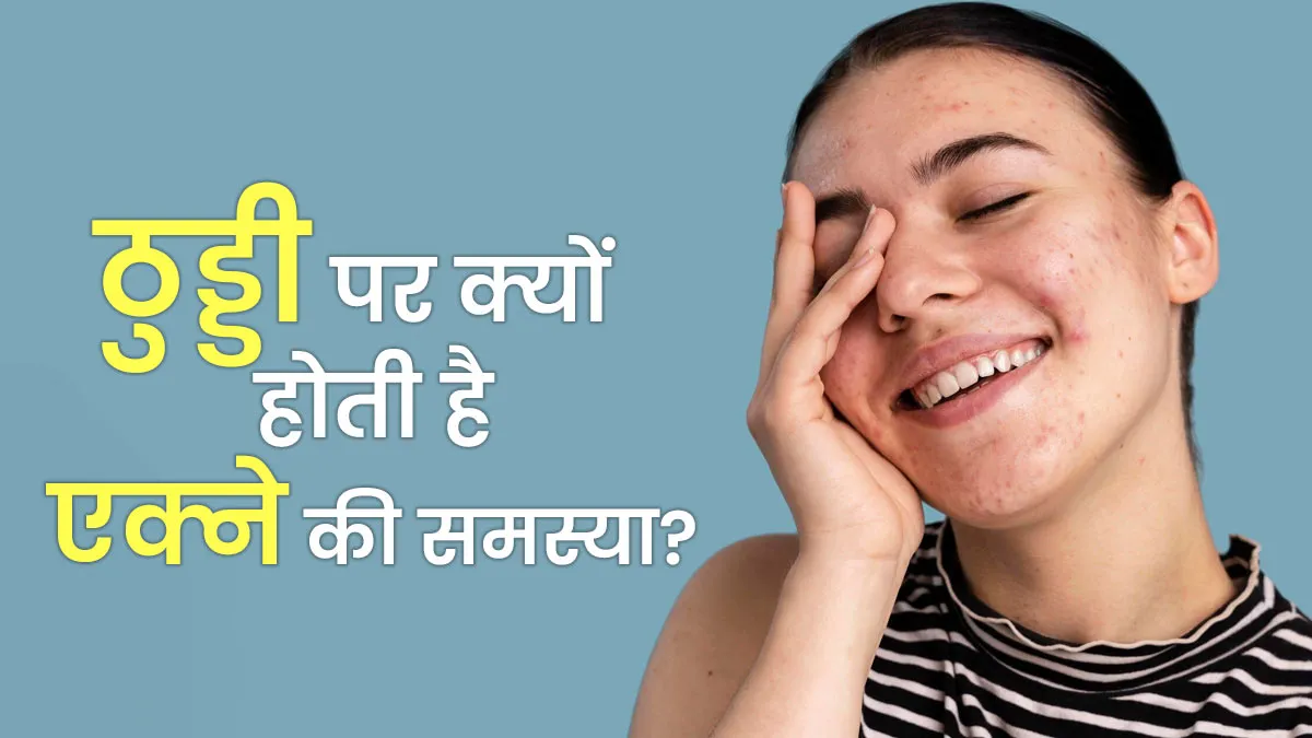 ठुड्डी पर क्यों होती है एक्ने की समस्या? डॉक्टर से जानें