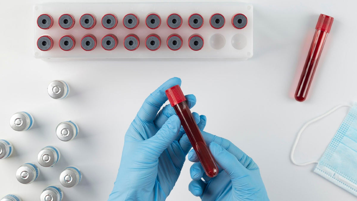 water_for_blood_urea_nitrogen