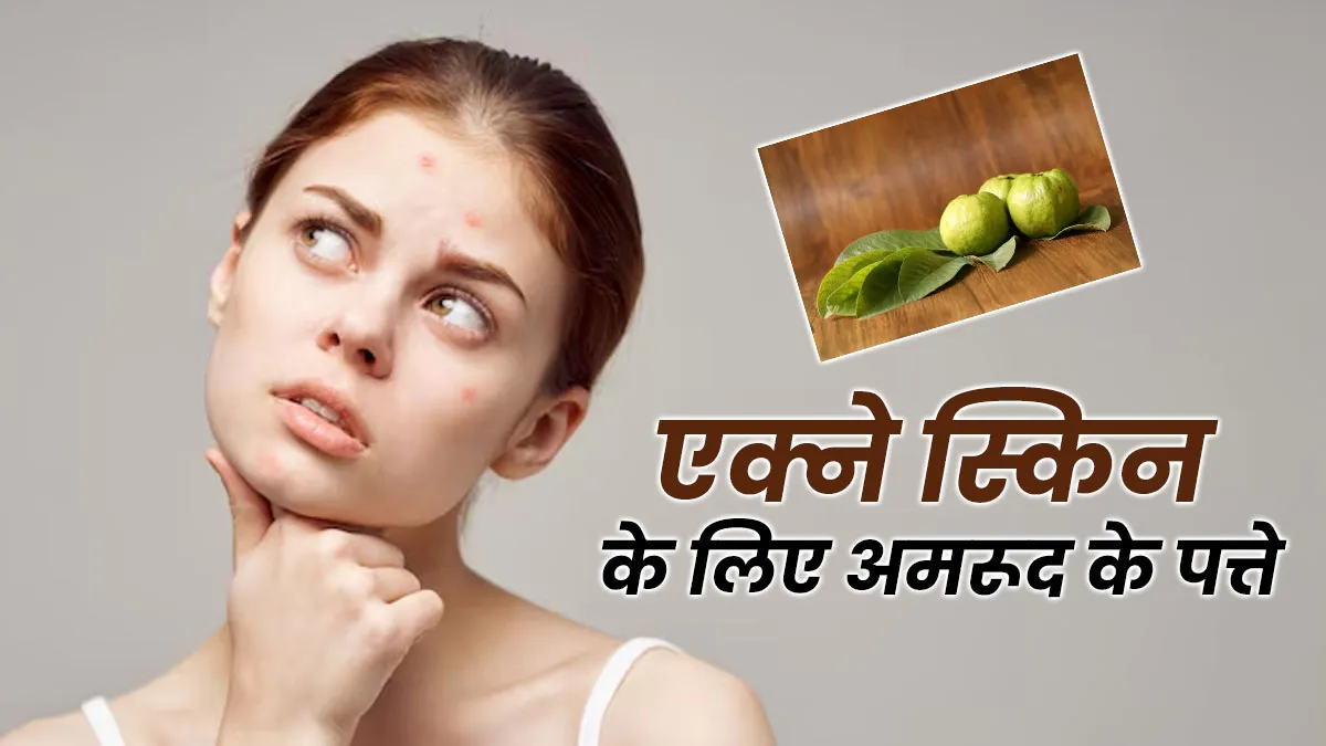 एक्ने की समस्या दूर करने के लिए इन 5 तरीकों से इस्तेमाल करें अमरूद के पत्ते, दाग-धब्बों से मिलेगा छुटकारा