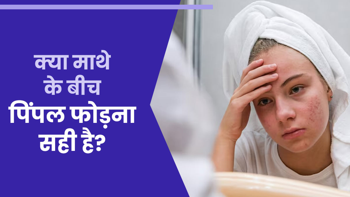 क्या माथे के बीच हुए पिंपल को फोड़ना सुरक्षित है? जानें डर्मेटोलॉजिस्ट से