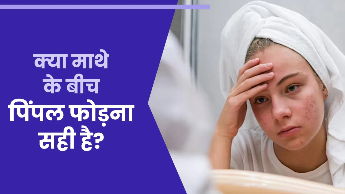 क्या माथे के बीच हुए पिंपल को फोड़ना सुरक्षित है? जानें डर्मेटोलॉजिस्ट से