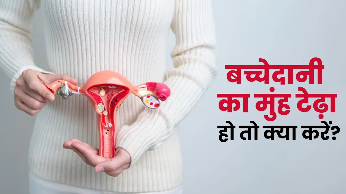 बच्चेदानी का मुंह टेढ़ा हो तो क्या करें? जानें इसके कारण और लक्षण