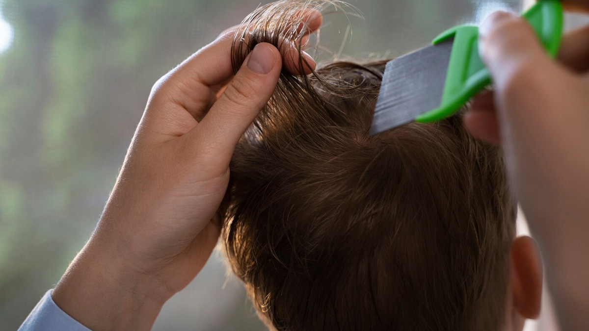 how to treat dry scalp on toddler