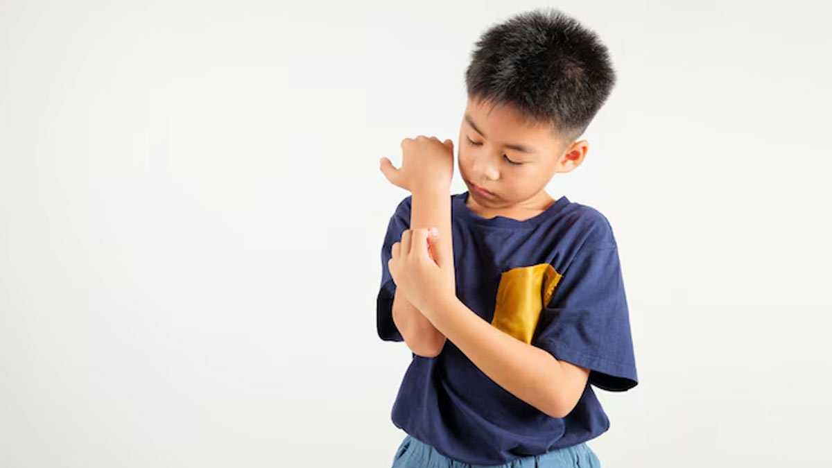 what to do if your child is allergic to dogs 01 (7)