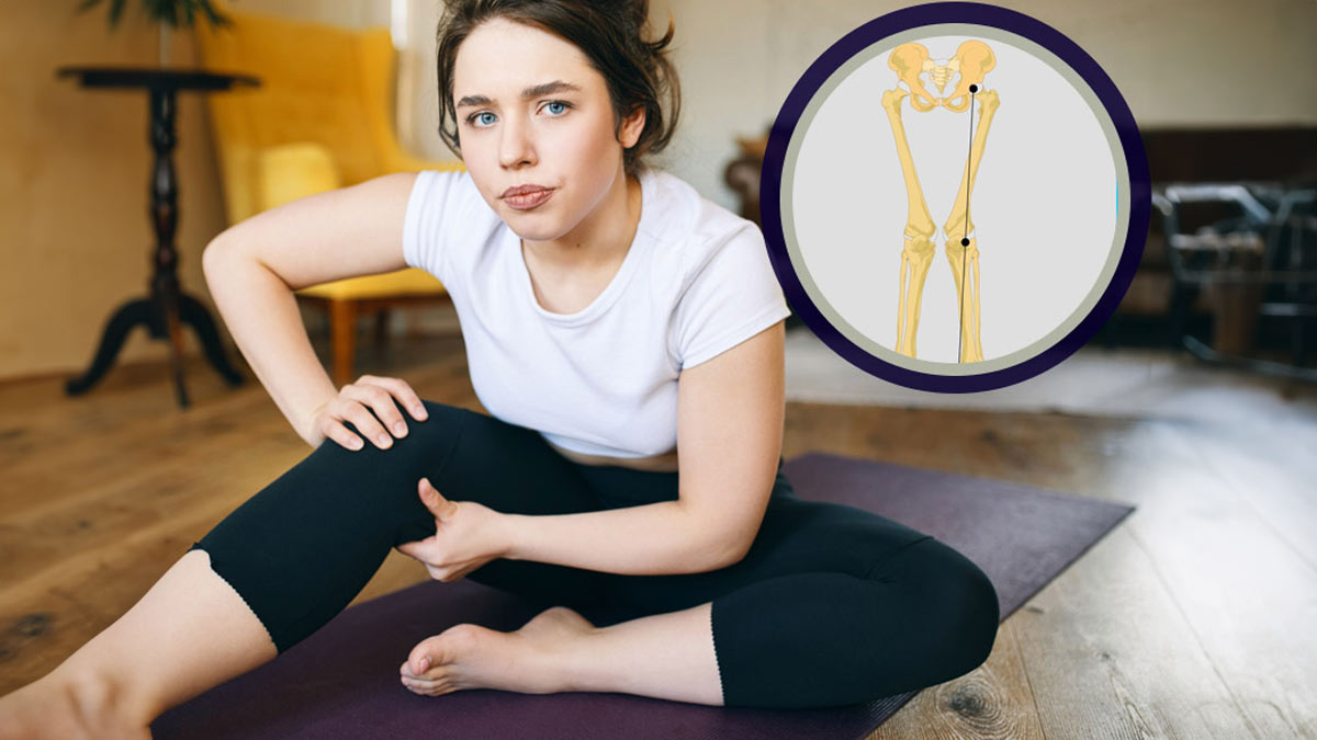 do flat feet cause knock knees in hindi 01 (5)