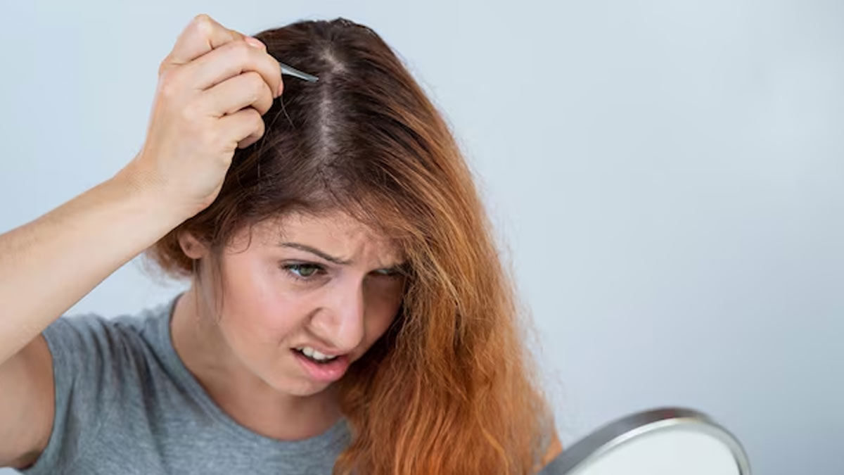 how to treat dandruff during pregnancy