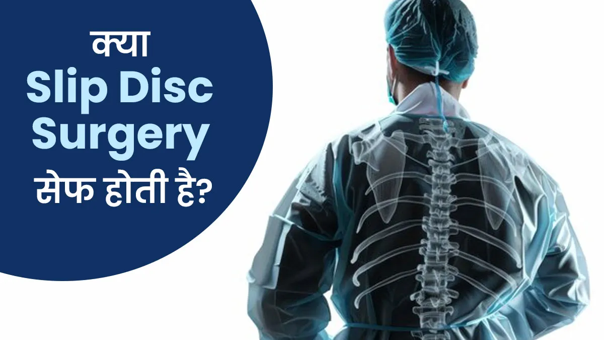 क्या स्लिप डिस्क सर्जरी सेफ होती है? डॉक्टर से जानें सच्चाई