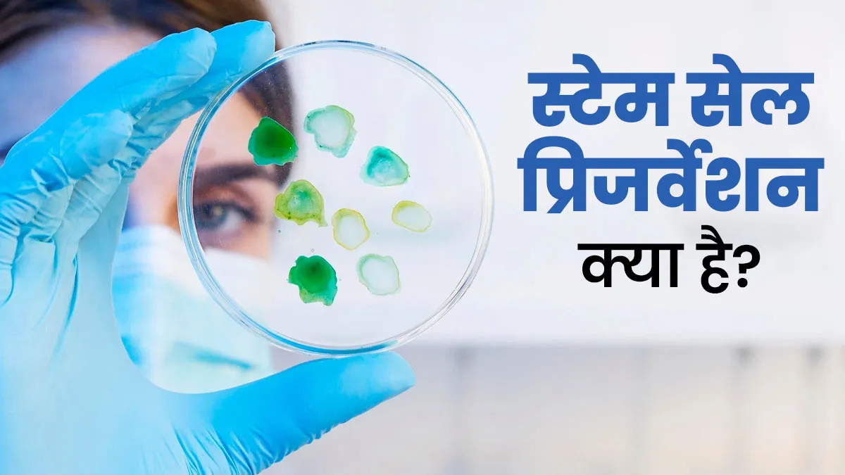 स्टेम सेल प्रिजर्वेशन क्या है, डॉक्टर से जानें फायदे