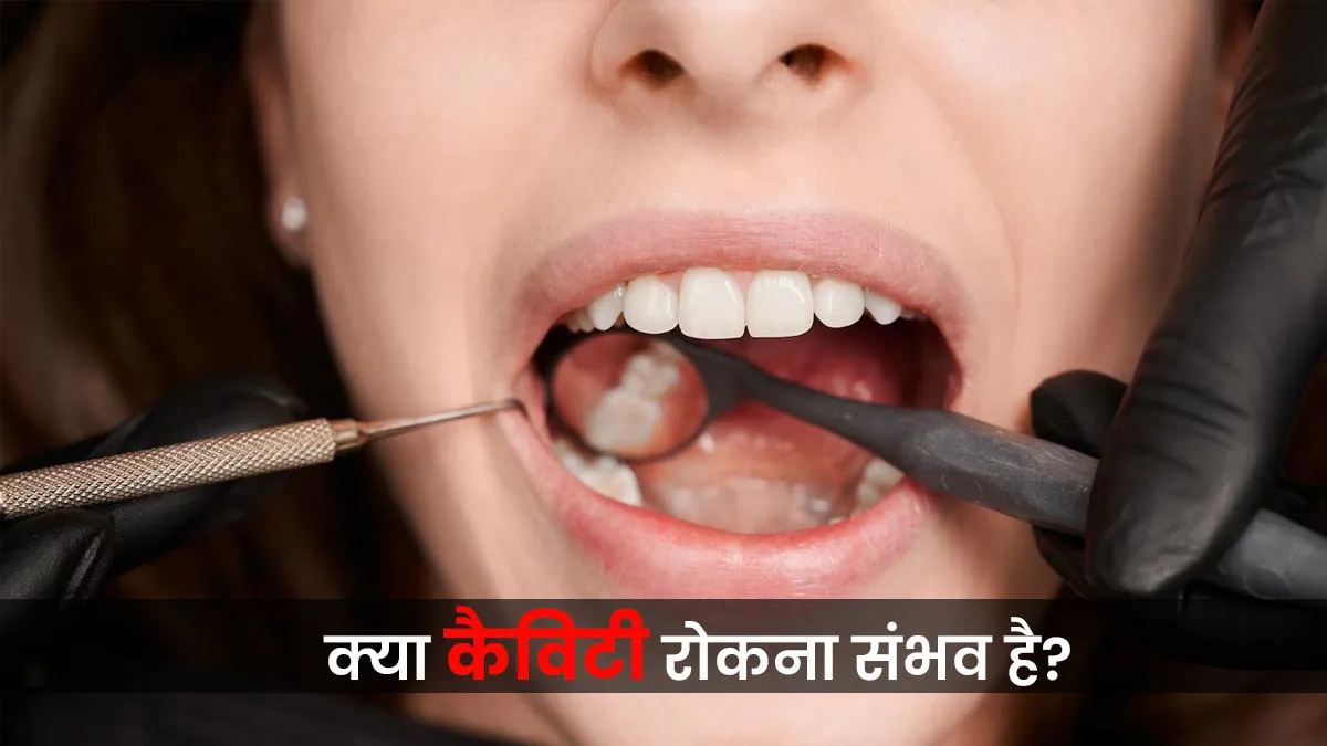 कैविटी शुरू हो गई है? डॉक्टर से जान लें क्या इसे रोकना अभी भी है मुमकिन