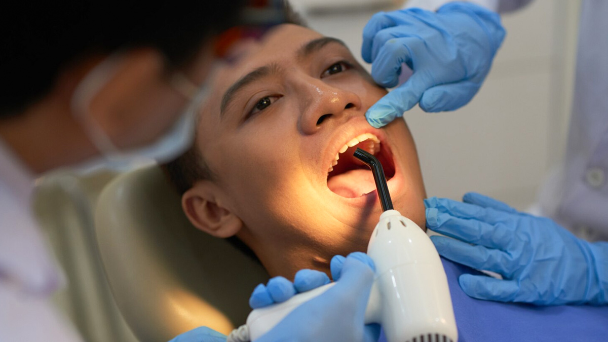 Can you stop a cavity once it starts