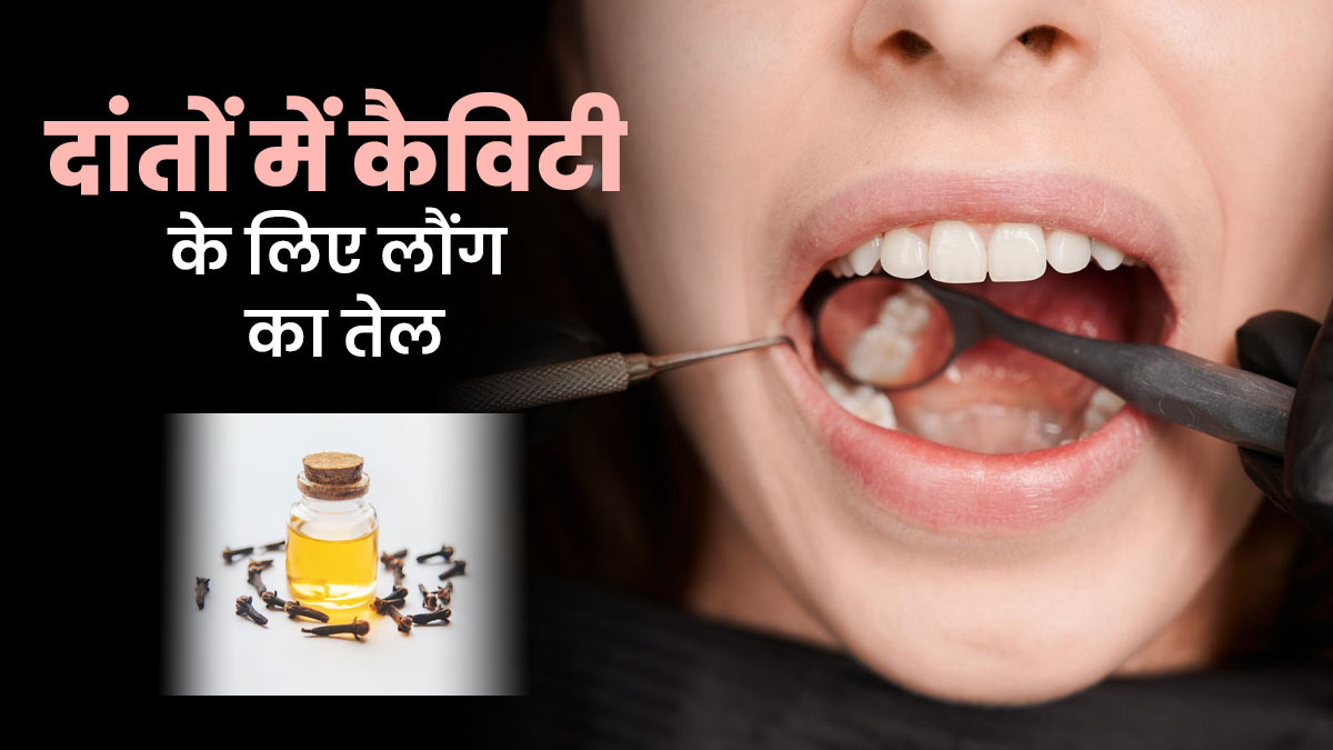 क्या लौंग का तेल दांतों में कैविटी बनने से रोक सकता है? आयुर्वेदाचार्य से जानें