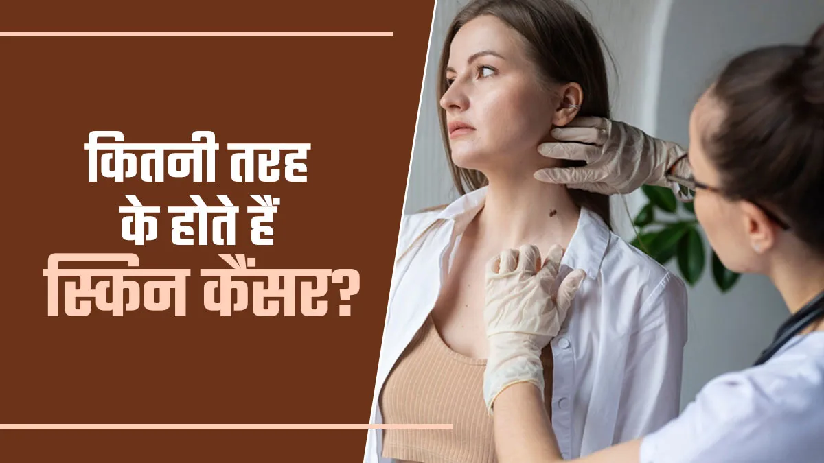 कितनी तरह के होते हैं स्किन कैंसर? जानें बचाव के उपाय