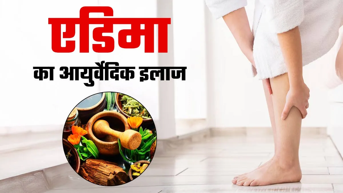 कौन सी जड़ी बूटी एडिमा से छुटकारा दिलाती है? आयुर्वेदिक एक्सपर्ट से जानें