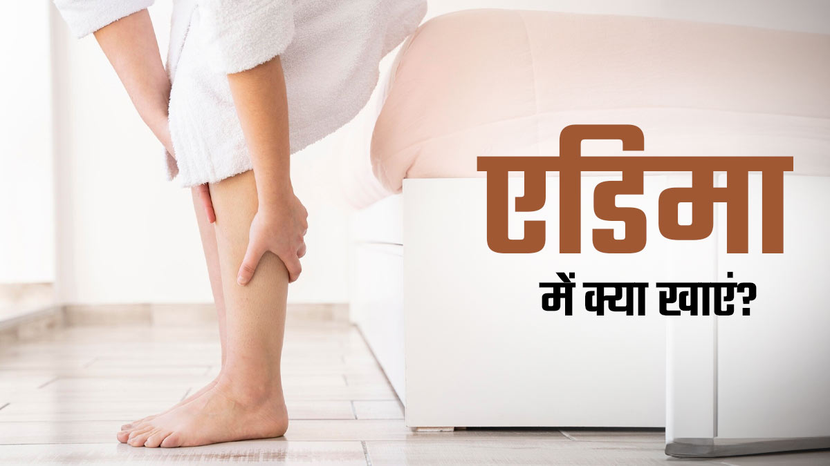 एडिमा में किन चीजों का सेवन करें? डॉक्टर से जानें