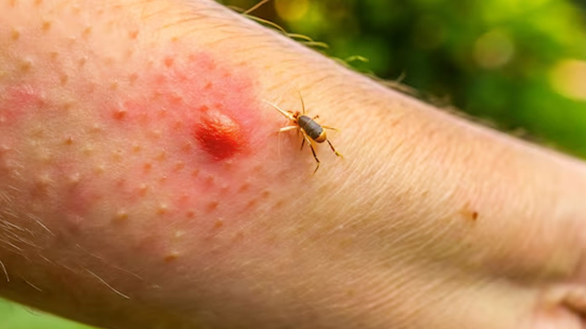 kissing-bug-america