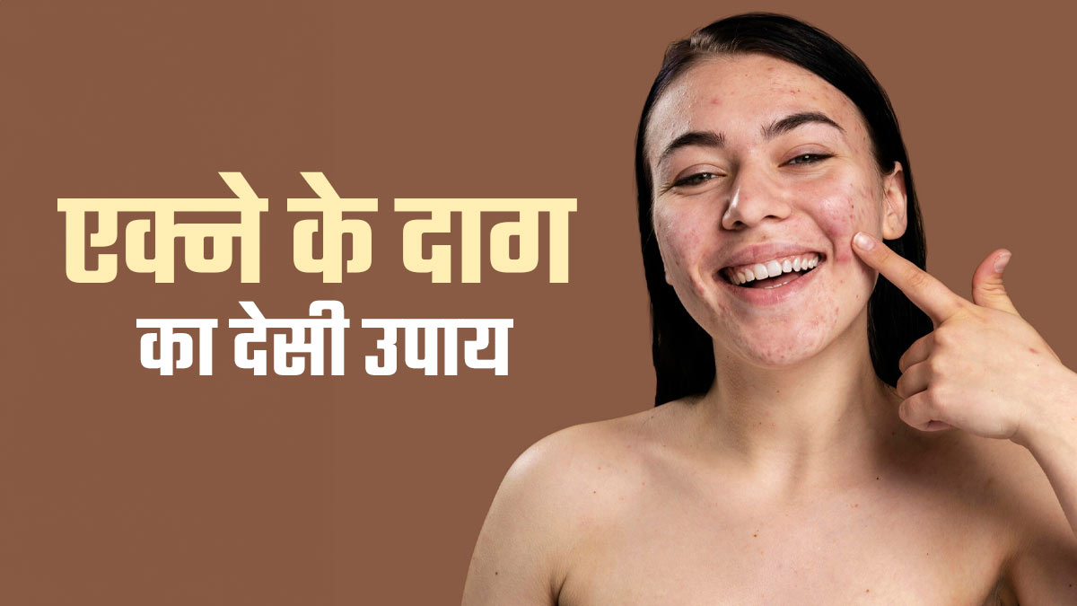 एक्ने के दागों को कम कर सकता है एवोकाडो सीड ऑयल? एक्सपर्ट से जानें कितना कारगर