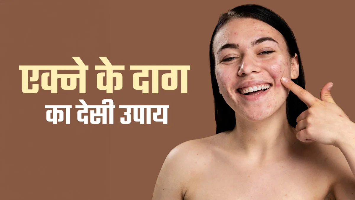 एक्ने के दागों को कम कर सकता है एवोकाडो सीड ऑयल? एक्सपर्ट से जानें कितना कारगर