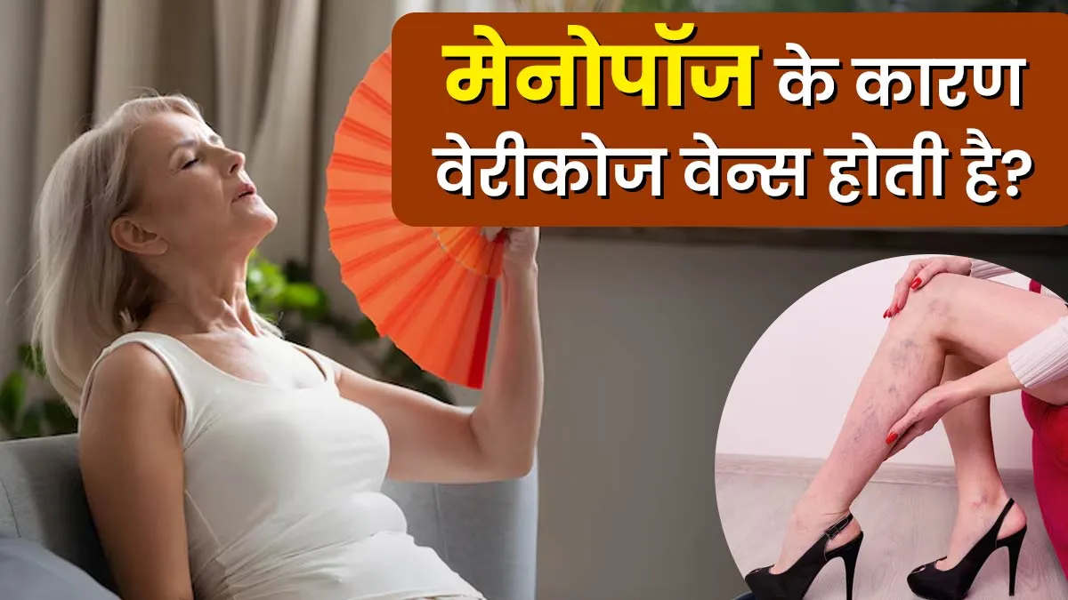 क्या मेनोपॉज के कारण वेरीकोज वेन्स की समस्या हो सकती है? डॉक्टर से जानें