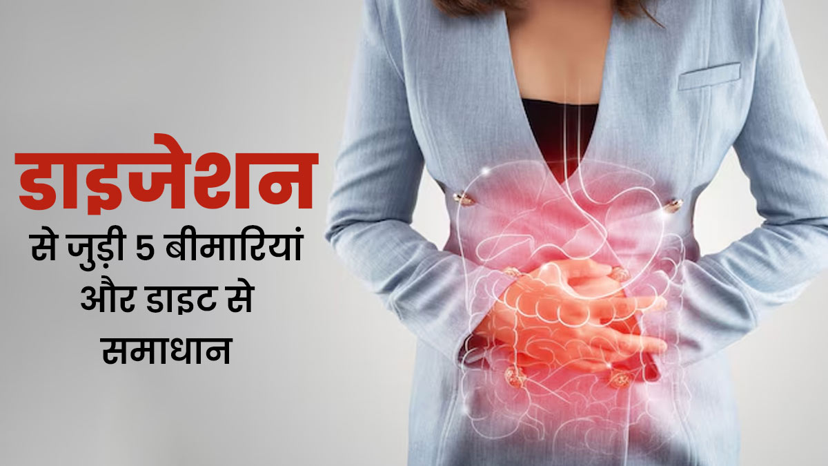 क्या आप भी डाइजेशन से जुड़ी 5 बीमारियों से हैं परेशान? डॉक्टर ने डाइट से मैनेज करने के बताए तरीके