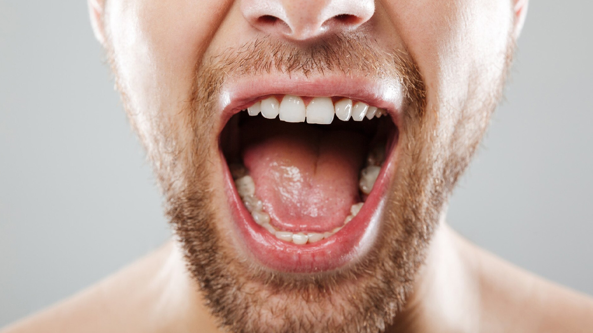 Heart attack oral bacteria