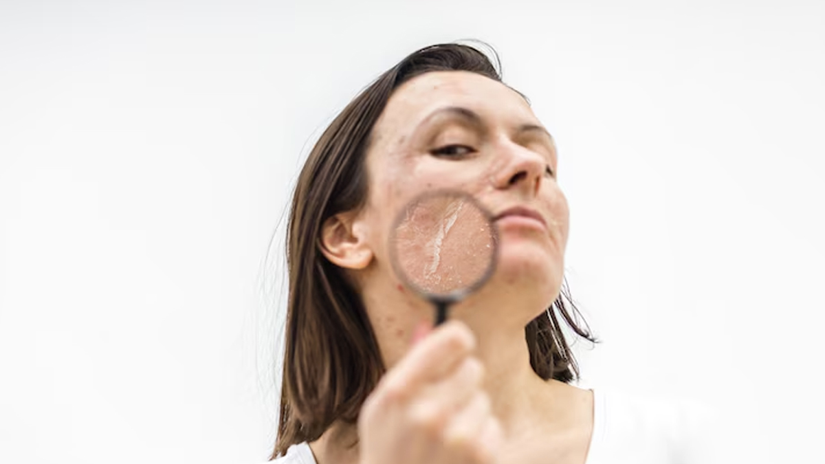 ghee_benefits_for_skin