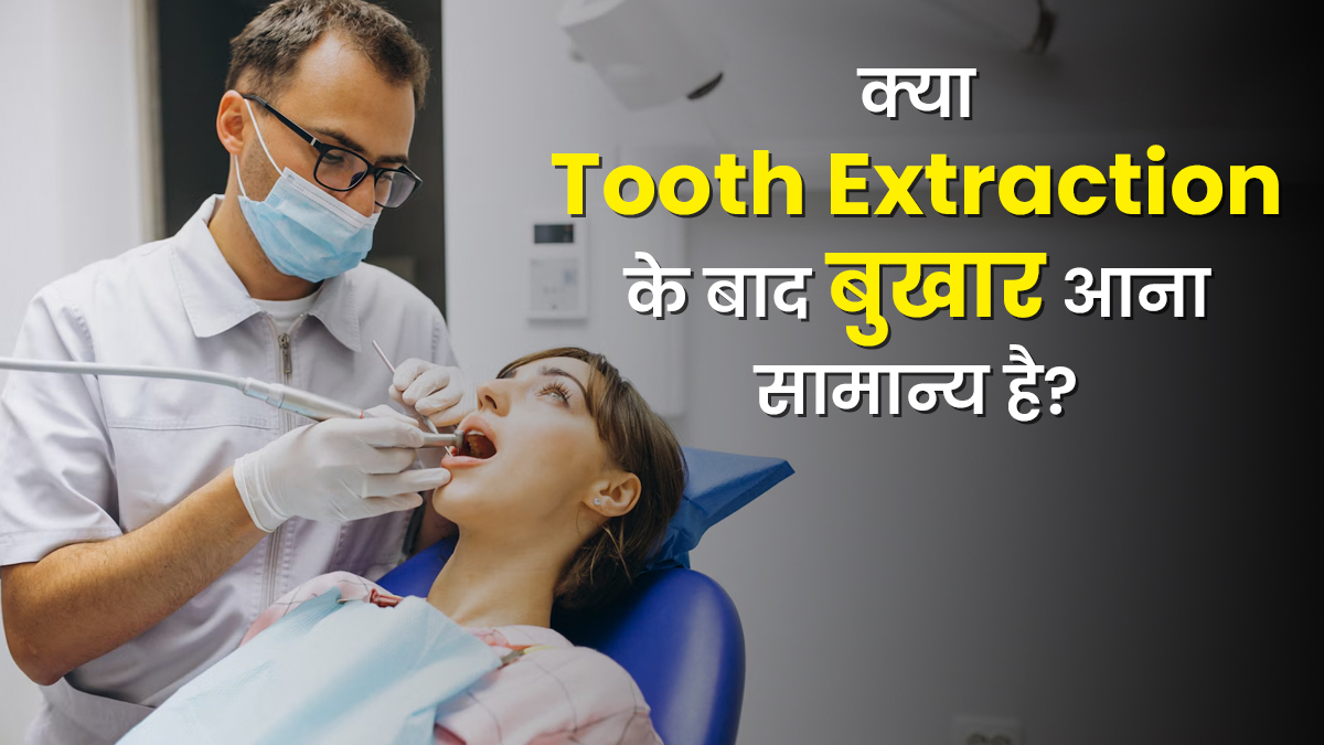 क्या वाकई अक्ल दाढ़ निकलवाने के बाद बुखार आना सामान्य है? जानें बचाव के टिप्स
