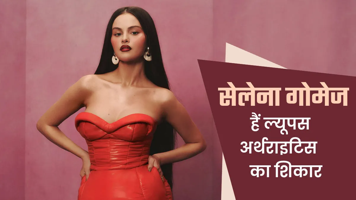 स‍िंगर-एक्‍ट्रेस सेलेना गोमेज को ल्यूपस के कारण हुआ अर्थराइटिस, जानें बीमारी के लक्षण