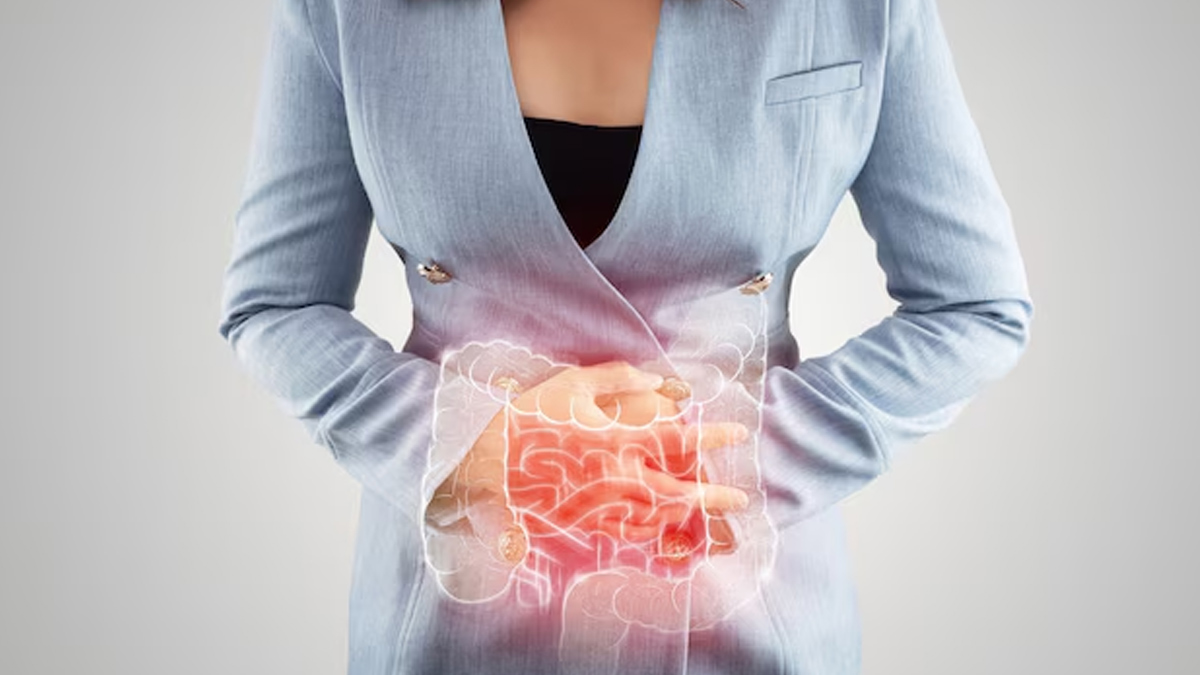 can ibs cause weight loss 1