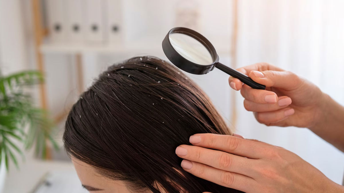 dry_scalp_near_hairline