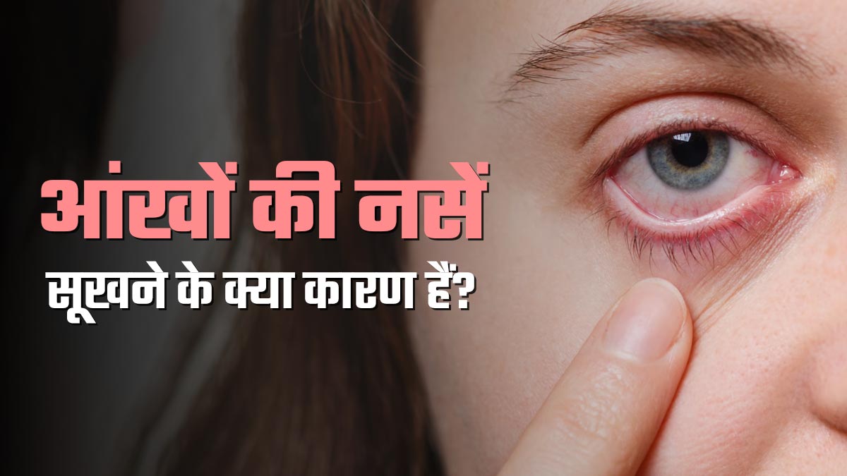 आंखों की नसें सूखने के क्या कारण हैं? डॉक्टर से जानें