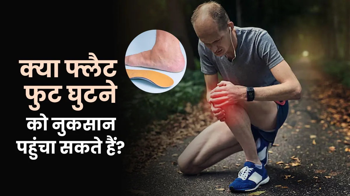 क्या फ्लैट पैर घुटने को नुकसान पहुंचा सकते हैं? डॉक्टर से जानें