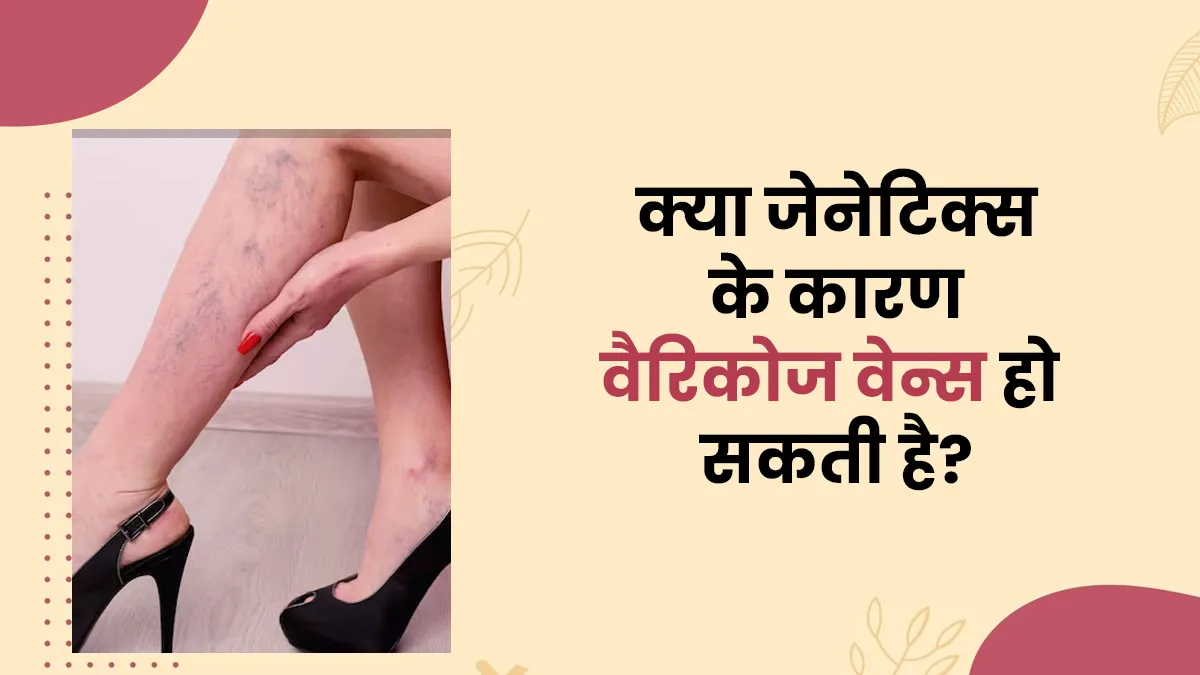 क्या जेनेटिक कारणों से भी वैरिकोज वेन्स की समस्या हो सकती है? डॉक्टर से जानें