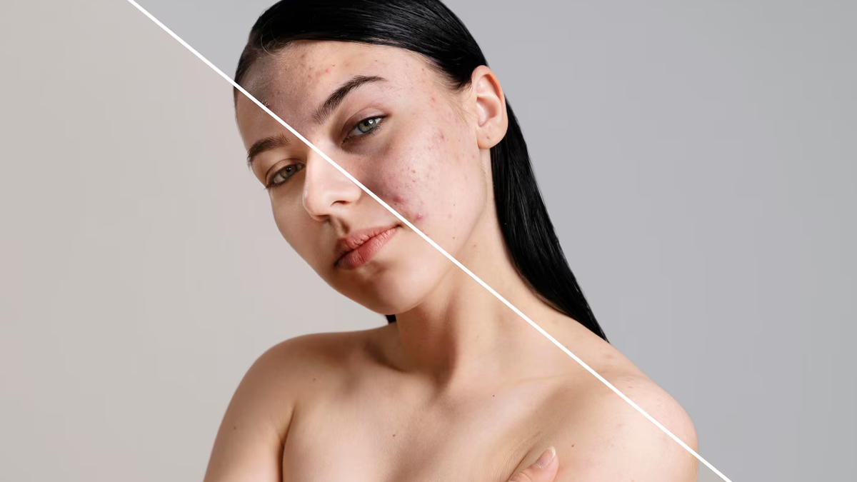 Benefits Of Drinking Turmeric Water In Empty Stomach For Skin 2 (1)