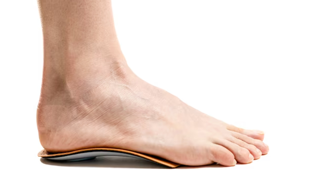 weak-hips-cause-flat-feet-inside