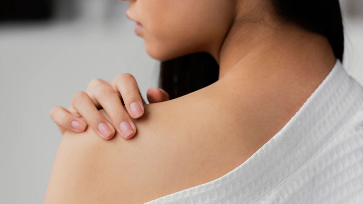 what causes stretch marks on shoulders  01 (9)