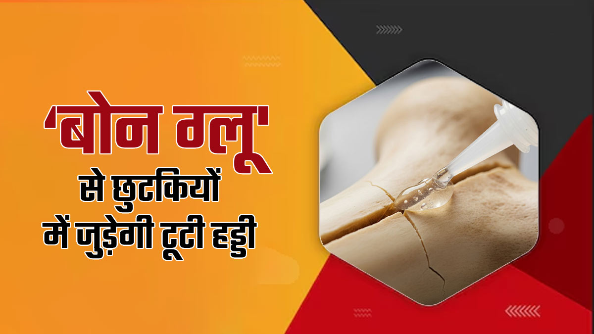 टूटी हड्डी को म‍िनटों में जोड़ देगा दुनिया का पहला ‘बोन ग्लू', सर्जरी से मिलेगी राहत