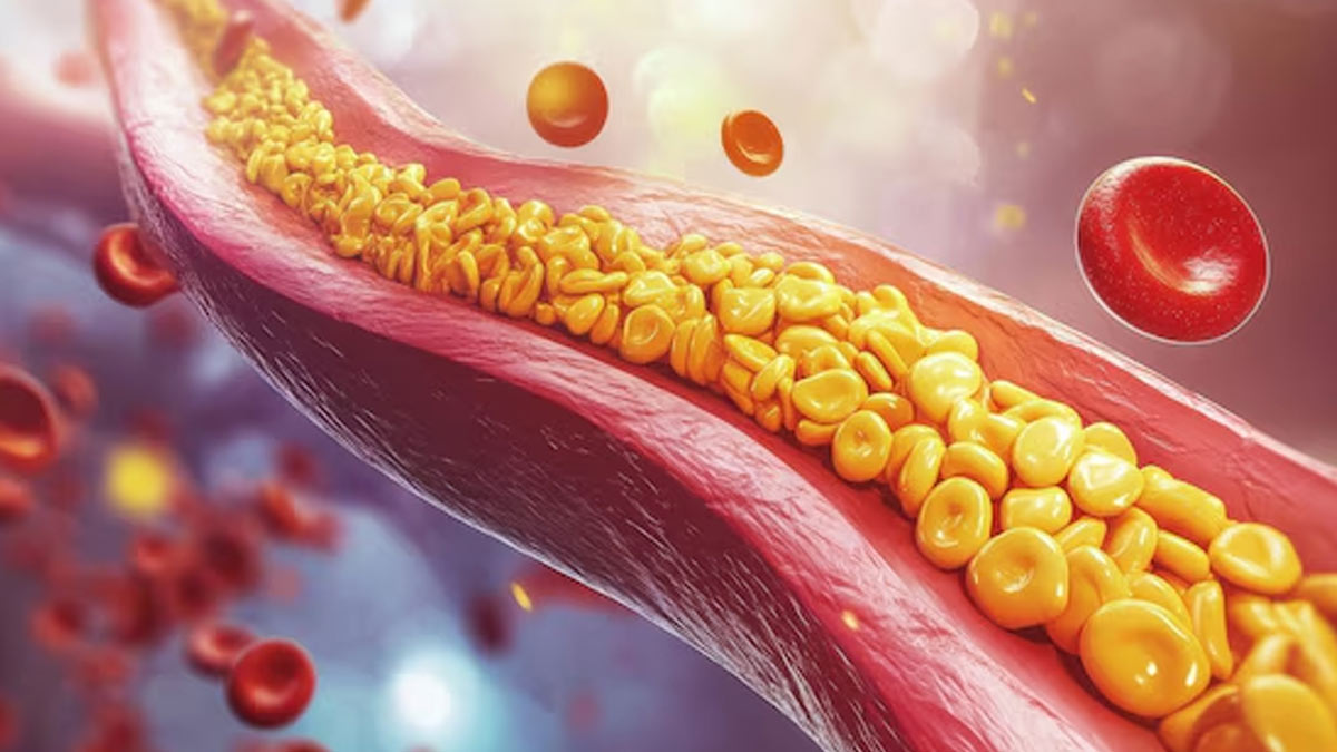 can high cholesterol cause weight gain in hindi 01 (5)