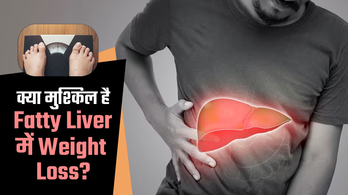 क्या वाकई फैटी लिवर के मरीजों के लिए मुश्किल होता है वेट लॉस करना है? खुद बता रहे हैं एक्सपर्ट