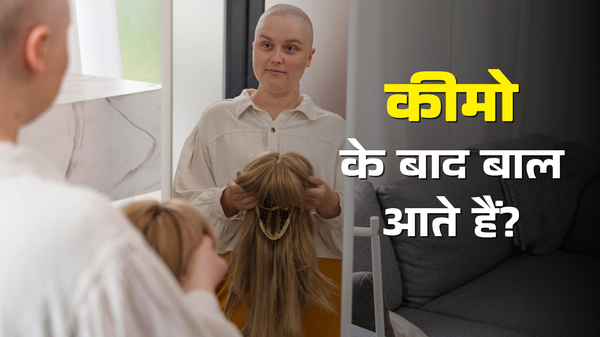 क्या कीमोथेरेपी के बाद कभी वापस नहीं आते बाल? डॉक्टर से जानें
