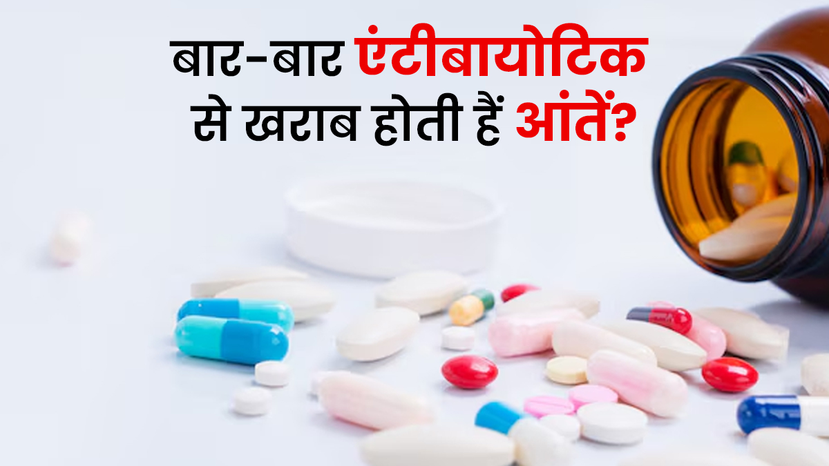 बार-बार एंटीबायोटिक लेने से खराब होती है आंतों की सेहत? डॉक्टर से जानें