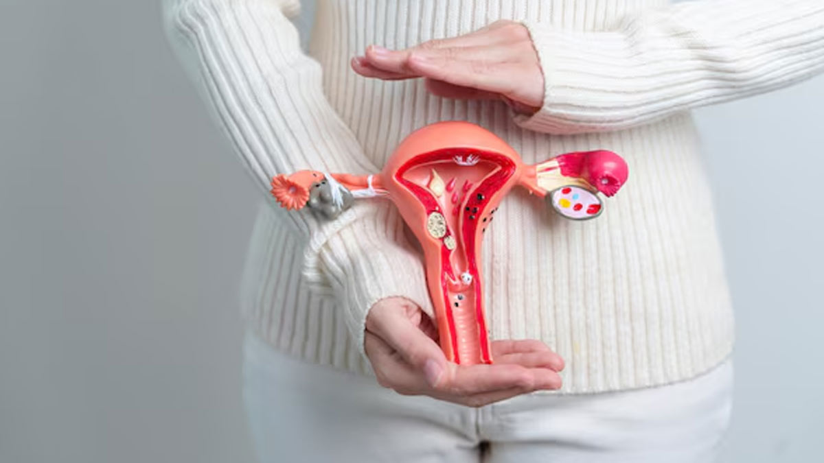 is it hard to lose weight with polycystic ovarian syndrome 01 (9)