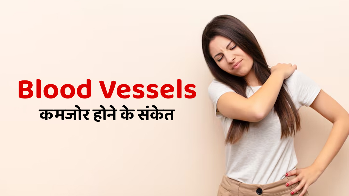 ब्लड वेसेल्स कमजोर होने के 4 संकेत, न करें अनदेखी