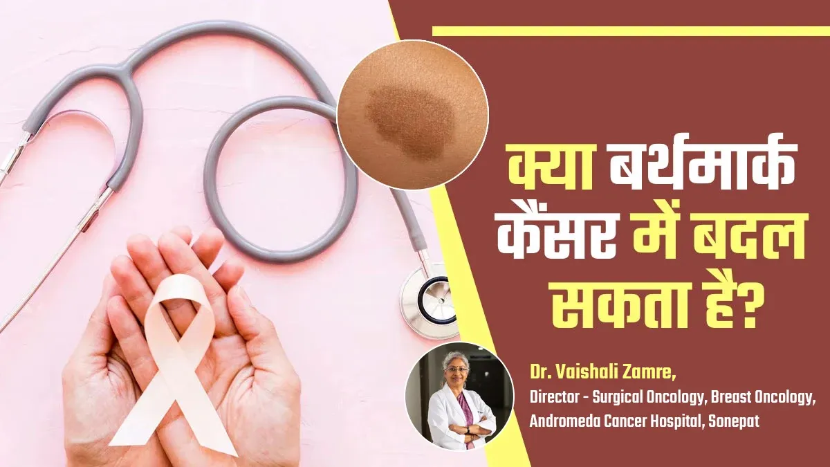 क्या बर्थमार्क कैंसर में बदल सकता है? डॉक्टर से जानें